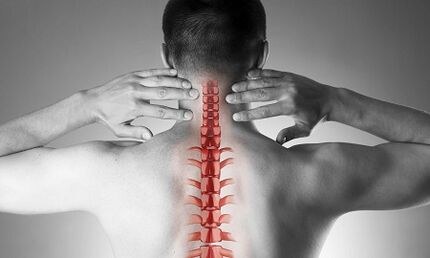 Servikal omurganın osteokondrozu kendini nasıl gösterir