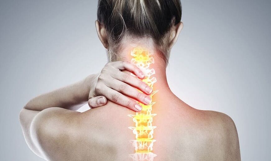 Servikal omurganın osteokondrozu